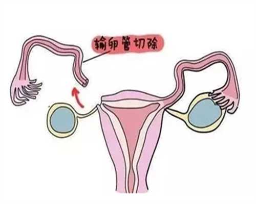 北京代孕双胞胎案例,北京供卵试管包成功博客,北京国内试管供卵机构