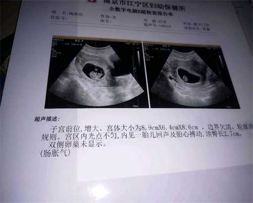 北京有偿捐卵-北京捐卵的网站