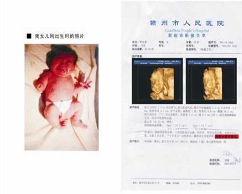 中国捐卵价格_深圳被查捐卵代孕组图_第三代试管捐卵助孕公司
