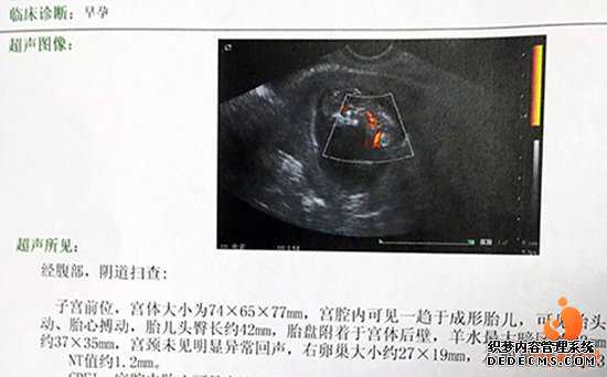 北京接受捐卵怀孕_昆华医院试管婴儿取卵打麻醉吗