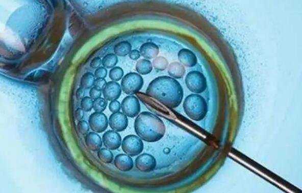 捐卵试管多少钱_正规捐卵试管婴儿_不育原因 可能是精子与卵子相互排斥
